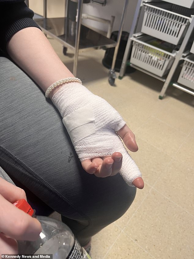 Her mother rushed Sophie to the University Hospital of Wales in Cardiff, where doctors told the family they were 'lucky' the burns were not more serious (Picture: Sophie in bandages)