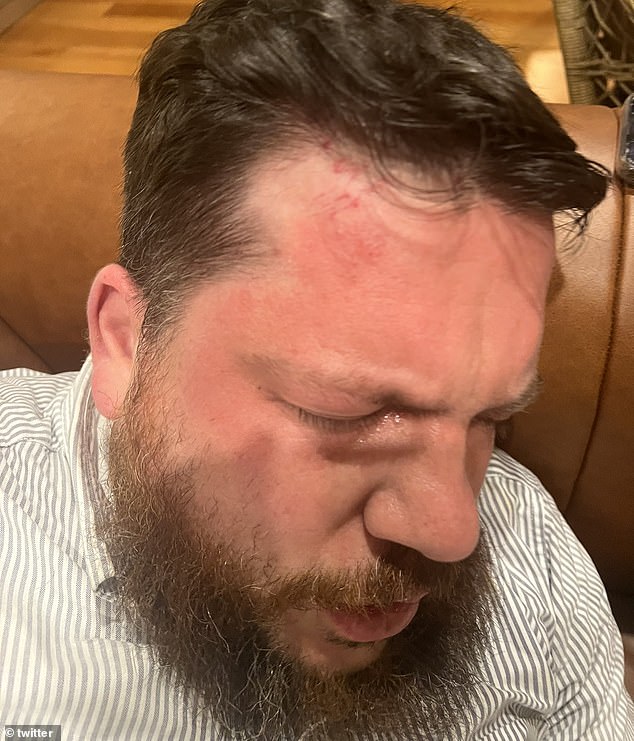 Photos of Volkov's injuries after his home was attacked in March revealed he had a black eye and a red mark on his forehead