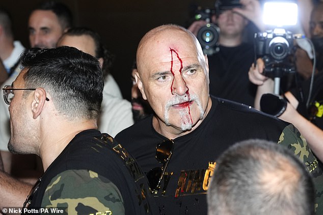 John Fury caused controversy in the build-up when he headbutted a member of the Usyks team