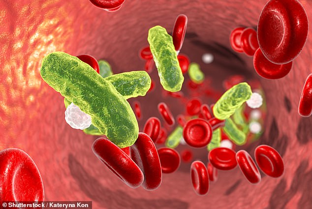 Bacterial infections are one of the most common causes of sepsis.  Blood tests may show an increase in the number of white blood cells, which indicates that an infection is present