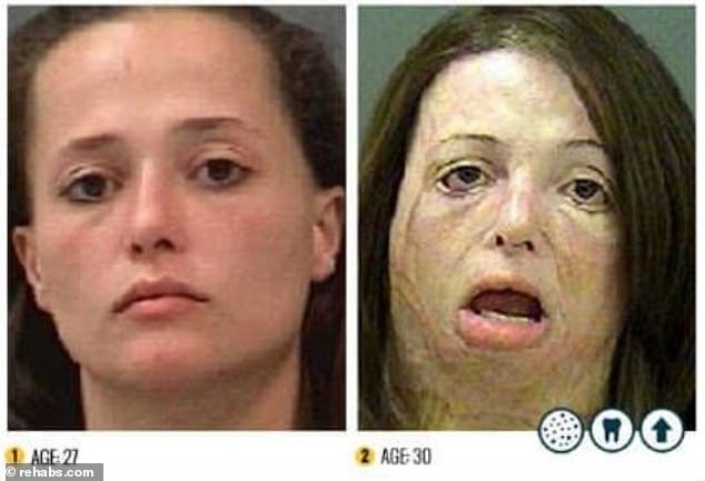 These photos, taken just three years apart, show how meth use has changed this woman's appearance in a short time