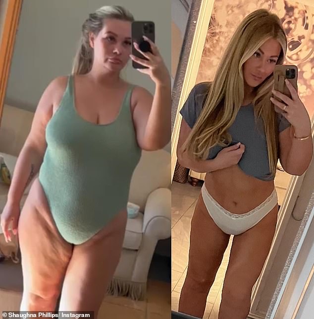 Shaughna told MailOnline after she shared two photos on Instagram to highlight her recent weight loss, she was accused of using Ozempic