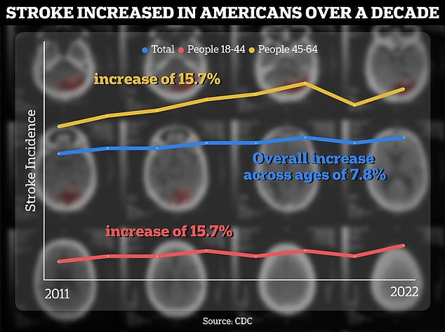 Comparing stroke cases between 2011 and 2013 with stroke cases between 2020 and 2022, the CDC report found that the number of strokes in people aged 18 to 64 increased by about 15 percent.