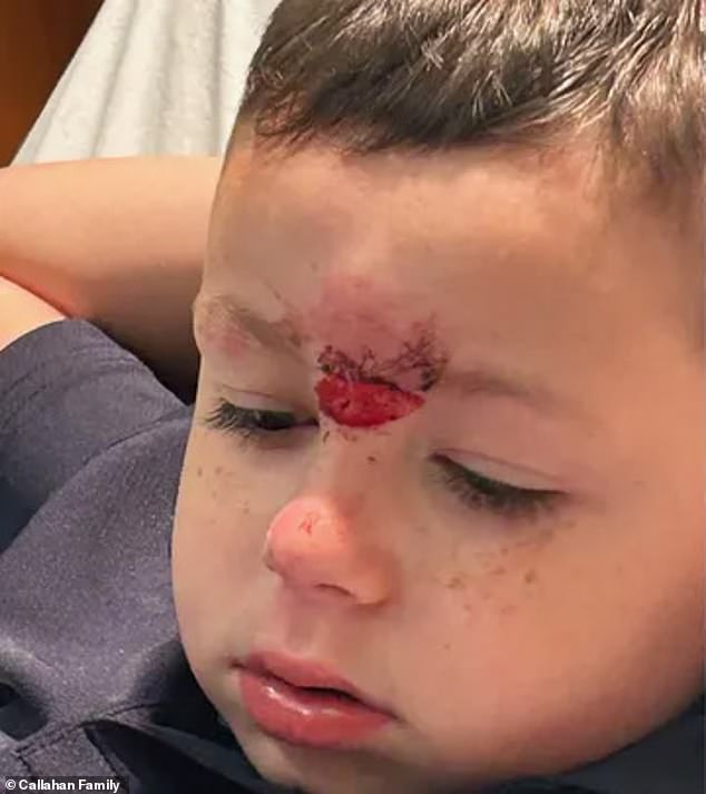 Grayson was taken to hospital with a deep cut on his forehead and missing teeth and is now 'too scared to go to school', according to his father
