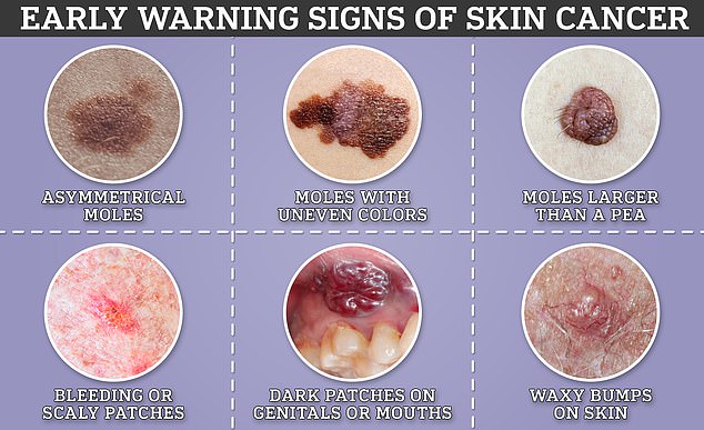 There are three types of skin cancer.  Each can present itself in different ways.  These include moles that are asymmetrical or abnormal, scaly or dark patches, and waxy bumps on the skin's surface