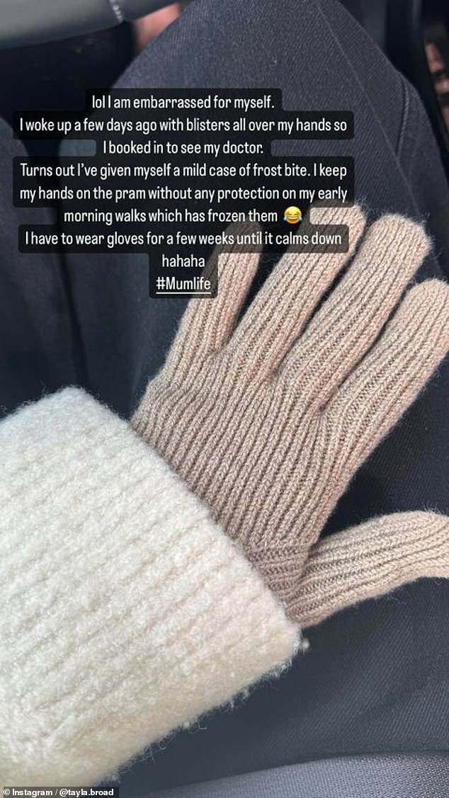 Tayla, who lives in Melbourne, said she was shockingly told she had given herself a 'mild case of frostbite' by pushing the stroller without gloves