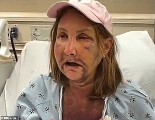 A second woman, Mary Klein, 54, was also brutally attacked on April 6 while walking near her home, leaving her with a broken jaw, missing teeth and extensive bruising to her face.