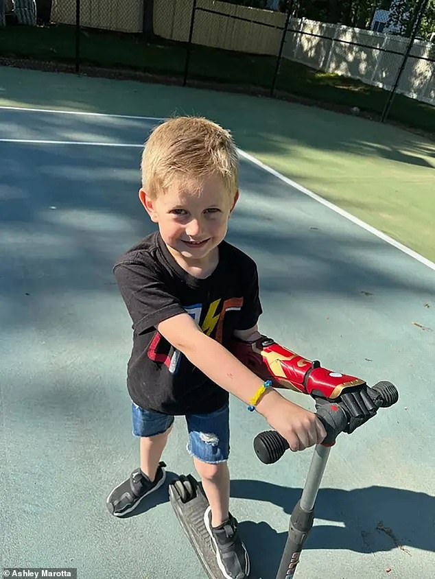 Jordan can now grip his scooter with his new Hero Arm
