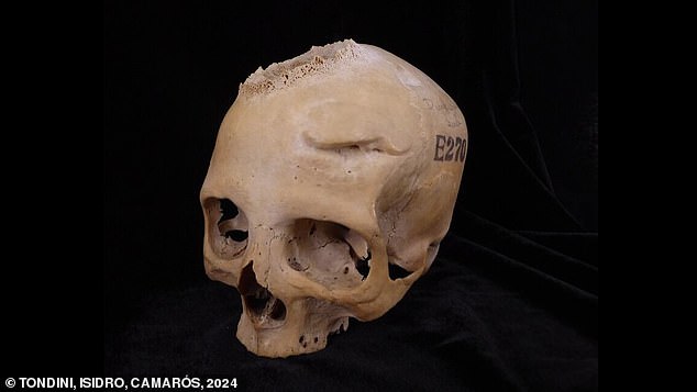 In the study, an international team of researchers examined two human skulls, each thousands of years old