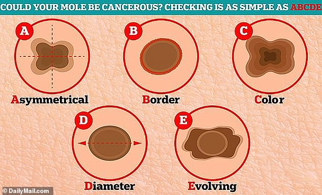 Annual full-body skin checks are recommended, but people can perform periodic self-checks at home.  When taking the exam, people should pay attention to the ABCDEs of skin cancer