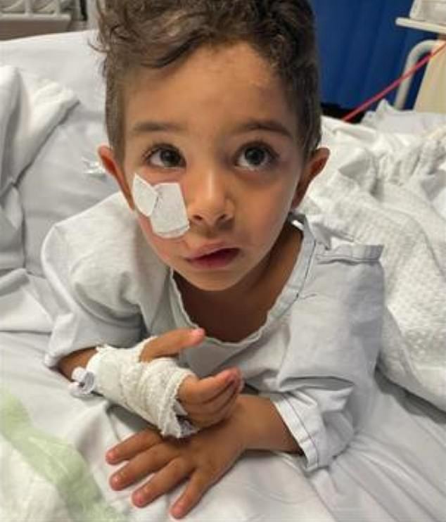 The young boy underwent surgery because he feared his facial injuries would leave permanent scars