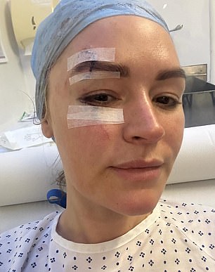 The TNT Sport presenter shared photos of her painful-looking injuries on social media