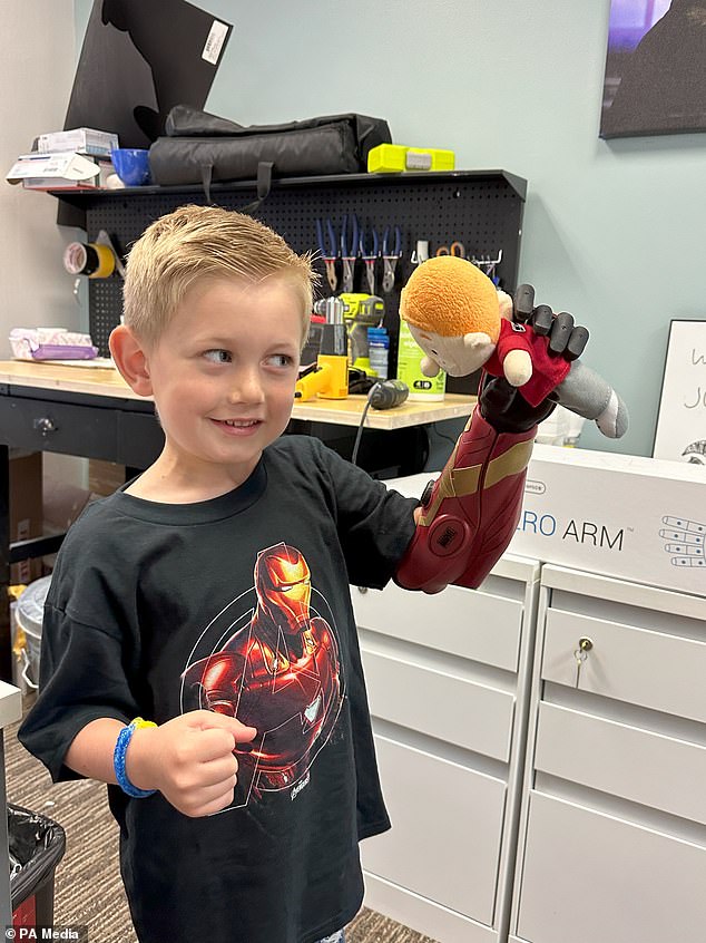 At the age of five, Jordan has become the youngest person in the world to receive a bionic Hero Arm