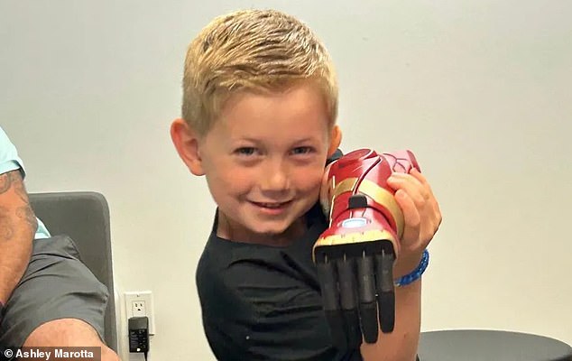 Jordan Marotta, 5, was born without a left hand and has become the youngest in the world to receive a bionic Hero Arm, which makes him 'feel like a superhero'