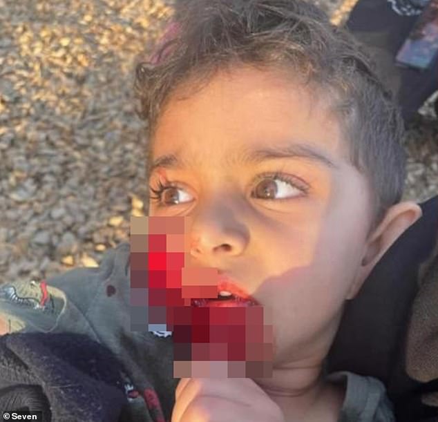 Basam Hafiz's three-year-old son was playing on the equipment at Pennington Reserve, north Adelaide, when he was attacked by a Tenterfield terrier about 4.30pm on Wednesday.