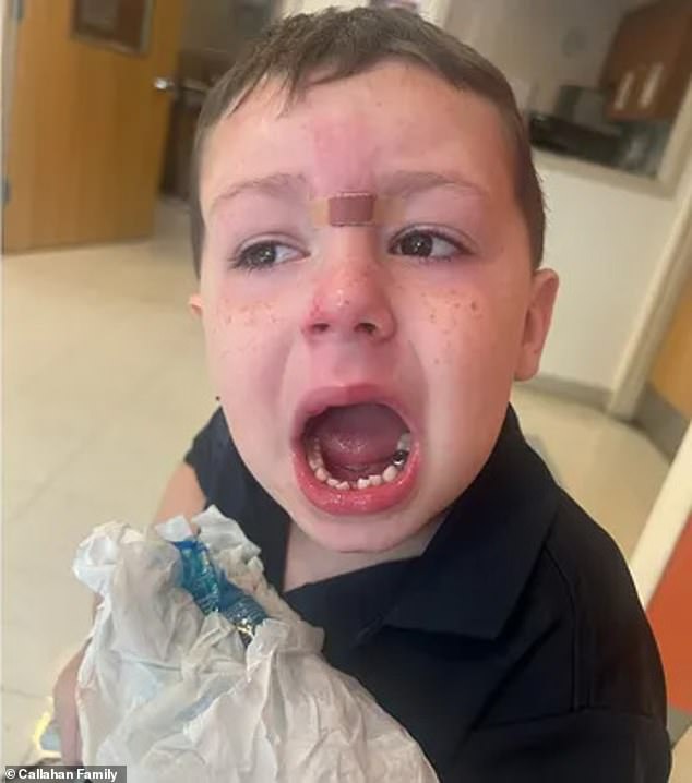 Stephen Callahan said his son Grayson was attacked by a special needs student in the school cafeteria while the student's teacher was 'not paying attention'