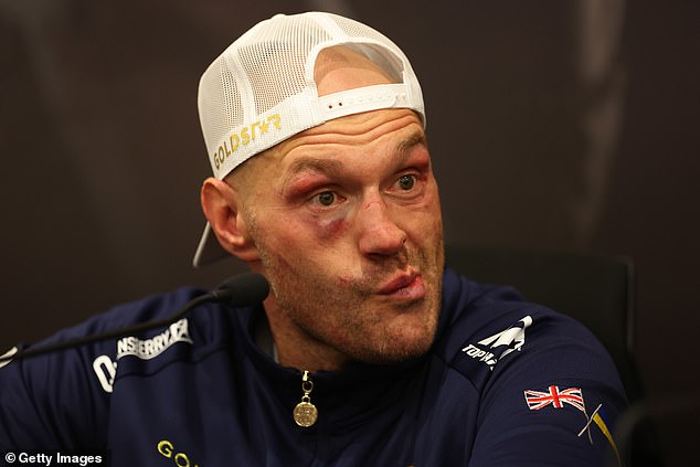Tyson Fury was given a one-week ban from boxing after his defeat to Oleksandr Usyk