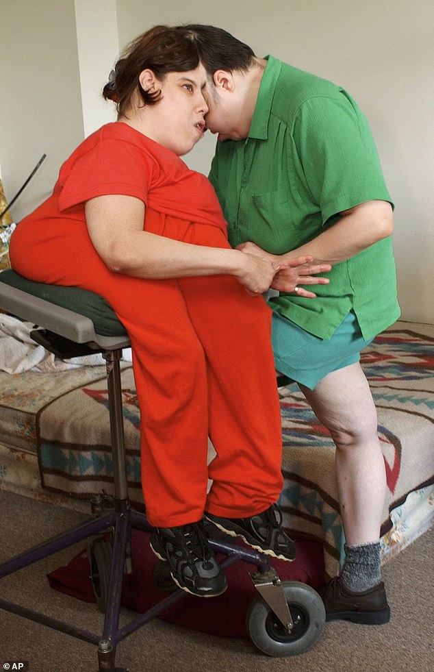 The pair became the first conjoined twins to identify as opposite sex in 2007, after Dori began identifying as George