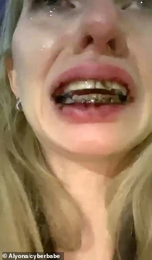 Model Elena Efremova said her braces were broken and there was 'a bloody mess of iron in my mouth, blood and bits of torn skin' after the attack