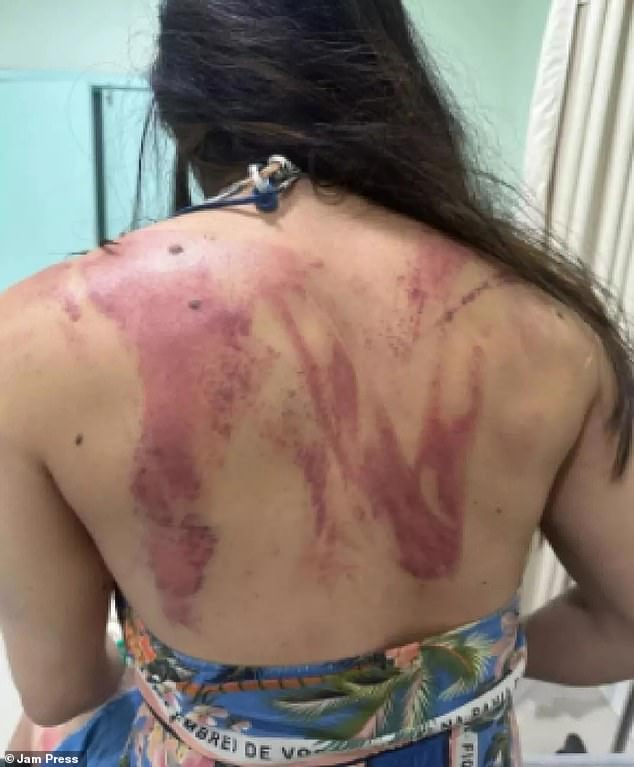 Bruna Tsuchiya suffered cuts and bruises after her father, Reinaldo Tsuchiya, hit her with a machete at their family hotel last Wednesday