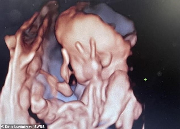 A British mother became hysterical after going for an ultrasound only to realize her unborn baby was swearing at her (pictured)