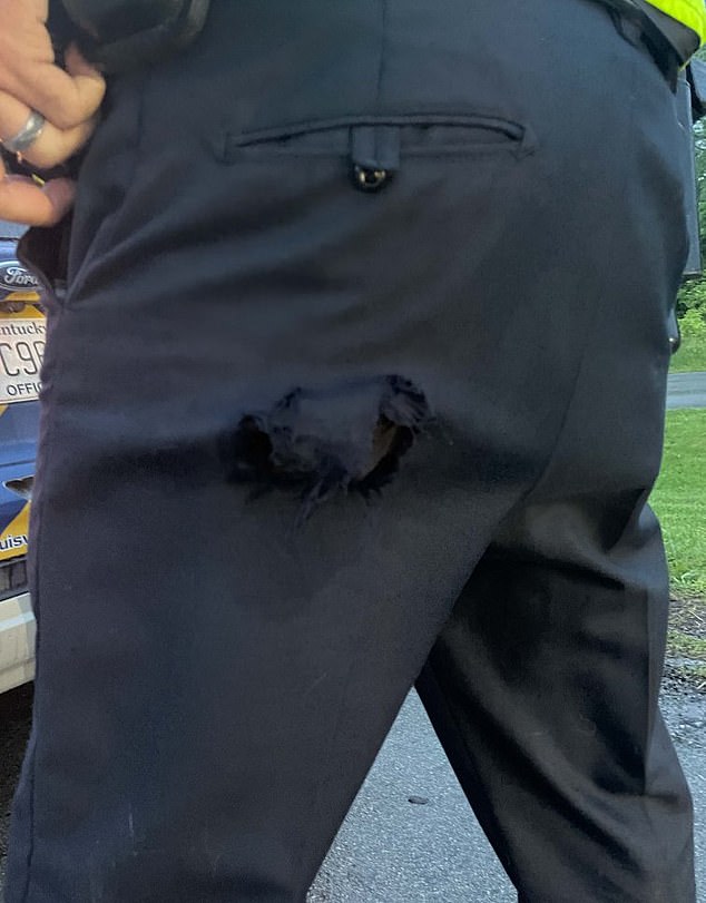 Minor cuts can be seen on the detective's knee and wrist, while his $80 pants - as he claimed in his police citation - are also significantly torn (pictured)