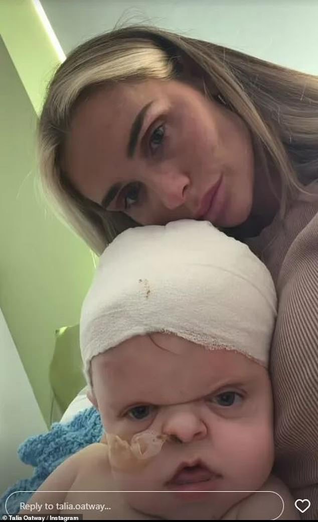 On Saturday evening, Talia said the little one needed another operation to address the fact that his cerebrospinal fluid was leaking.