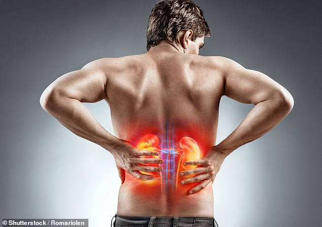 Astronauts would develop painful kidney stones (artist's impression) and could even need dialysis, according to the study