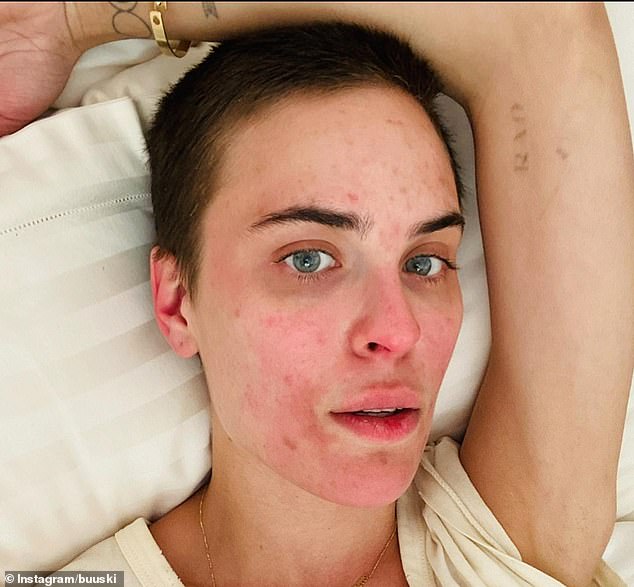 The actress' 'before' photo shows her skin covered in reddish, crusty cuts and scratches around her mouth, nose and eyes