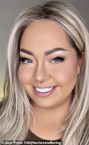 1718319448 103 Woman 37 with no front teeth leaves the internet STUNNED