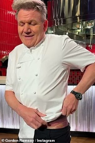 In the video, Gordon lifted his chef's jacket to reveal his injuries, with one side of his body covered in black and purple bruises.