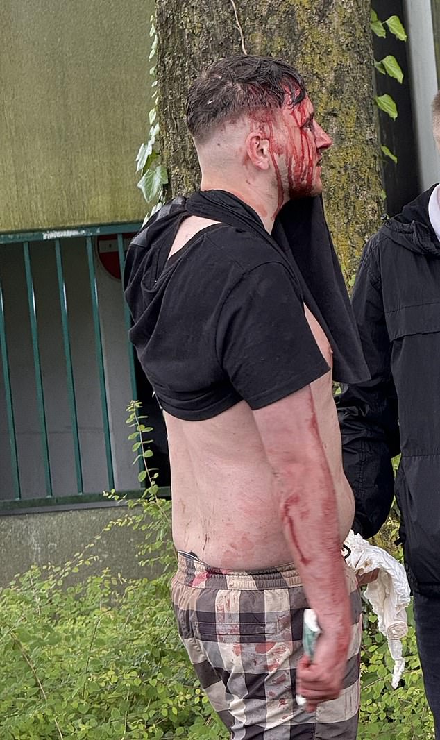 A football fan is seen covered in blood on Sunday after an altercation between England and Serbia fans