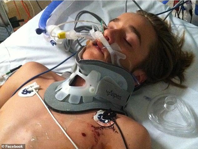 The then 15-year-old cyclist Ryan Meuleman suffered a punctured lung, broken ribs and lost 90 percent of his spleen (photo in the hospital after the crash)