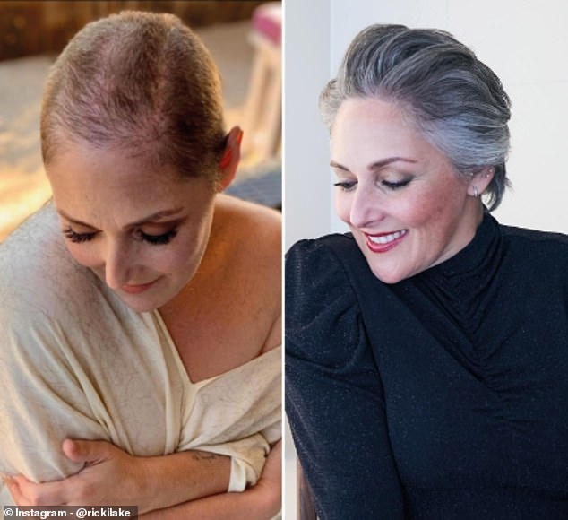 In addition to her weight, Ricki also suffered from hair loss due to years of depression and dangerous diets.  She has since overcome this (pictured left in 2019 and right in 2021