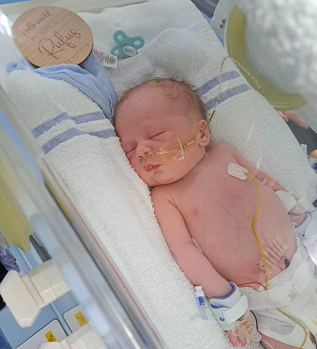 Rufus was diagnosed with cystic fibrosis when he was just a few days old, a genetic condition that causes sticky mucus to build up in the lungs and digestive system