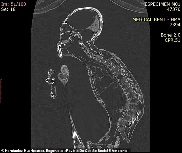 The image analysis also revealed that the creature suffered from arthritis in its hands and feet, along with a damaged spine