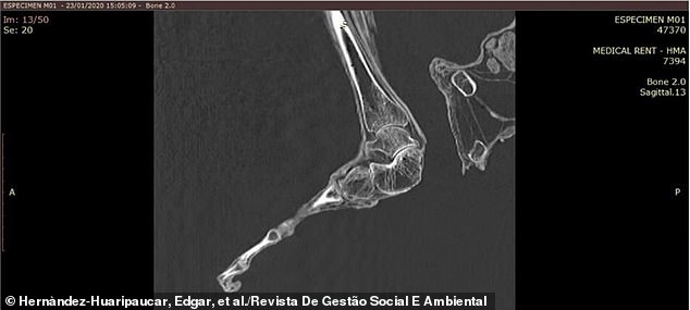 The specimen is missing a large bump in its foot that helps support its body weight and maintain balance when standing upright on two feet.  This suggested that he walked hunched over to remain stable