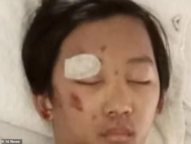 Benjamin spent six days in a coma (pictured) after suffering a fractured skull and a brain hemorrhage when he was reportedly dragged 150 yards from a stolen car driven by the group