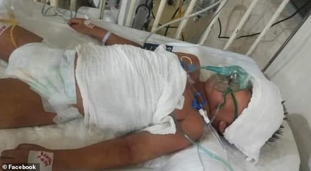 Friends and family of four-year-old Yahir Rivera took to Facebook on Thursday to search for potential blood donors.  The child was bitten by a tick and is currently in hospital in the Mexican border city of Ciudad Juárez