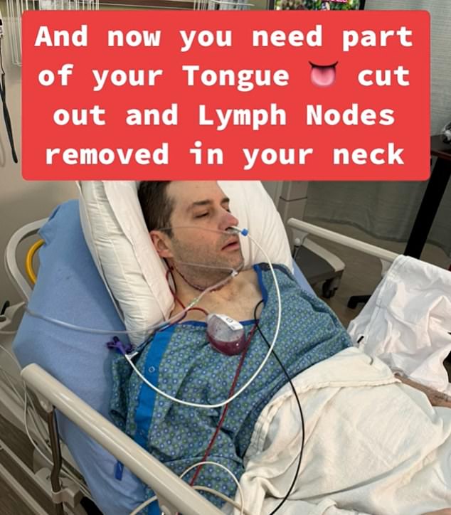 When tests revealed that Mark had tongue cancer, he underwent a procedure to remove part of his tongue and 41 lymph nodes in his neck.