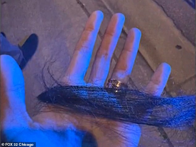 The woman photographed some of the hair that had been pulled from her head by the gang