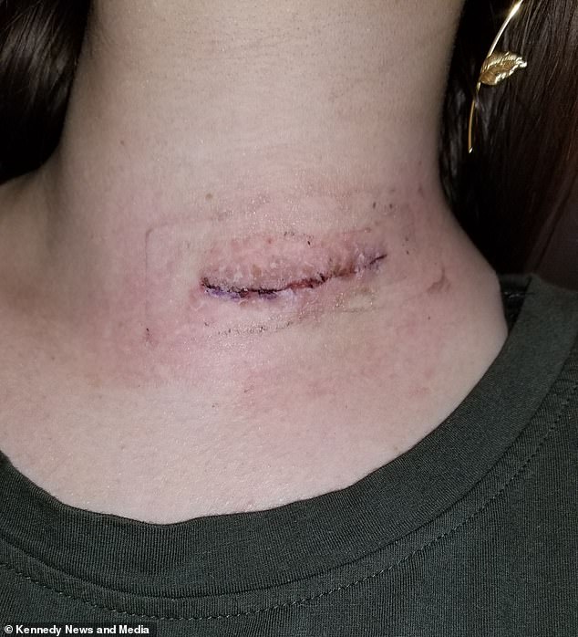 Jessica still has a hoarse voice from the incident — and had to pay $12,000 in medical bills to pay for all her treatments