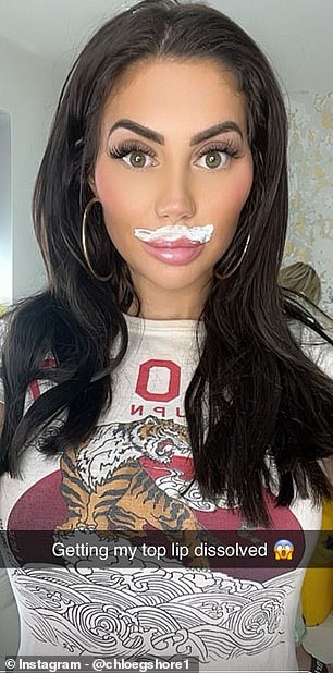 Chloe Ferry has announced she will be removing her upper lip filler, just two weeks after undergoing a breast reduction in Turkey