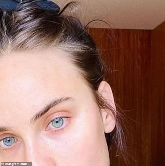 The 'after' photo reveals a much clearer, flawless face