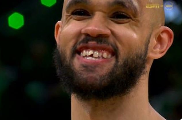 Derrick White chips tooth but luckily avoids SICKENING injury in