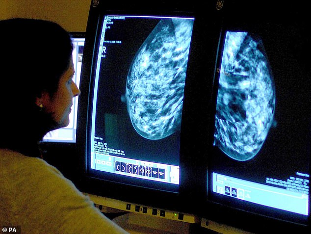 On average, breast cancer returns between three and 25 percent of the time.  Experts believe that young, obese women are at greatest risk, as are women with more aggressive types