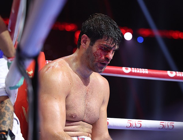 Filip Hrgovic suffered serious cuts above both eyes, resulting in an eighth-round stoppage against Daniel Dubois