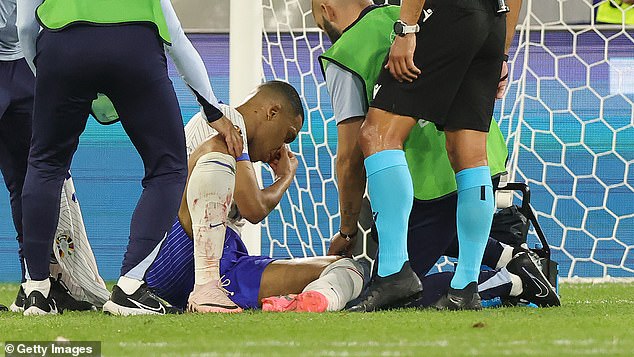 Kylian Mbappe will not need surgery despite his broken nose against Austria