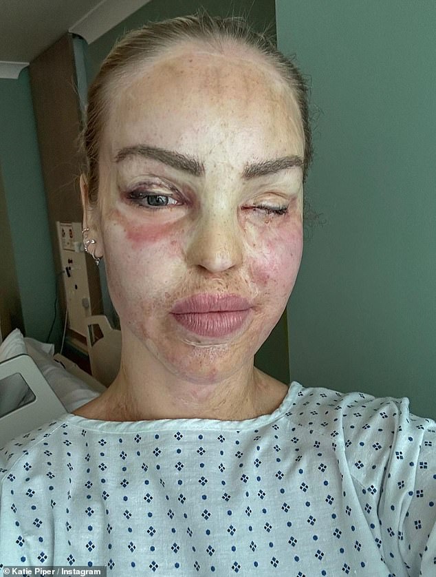 Katie wrote: 'Unfortunately I won't be attending my breakfast show this weekend as I have had to undergo an unexpected medical procedure.  Everything is going well' (pictured in 2023)