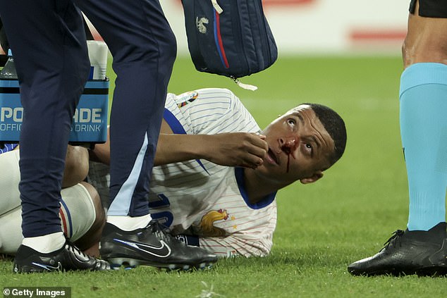 Kylian Mbappé suffered a horrific broken nose during the opening match of the 2024 European Championship in France